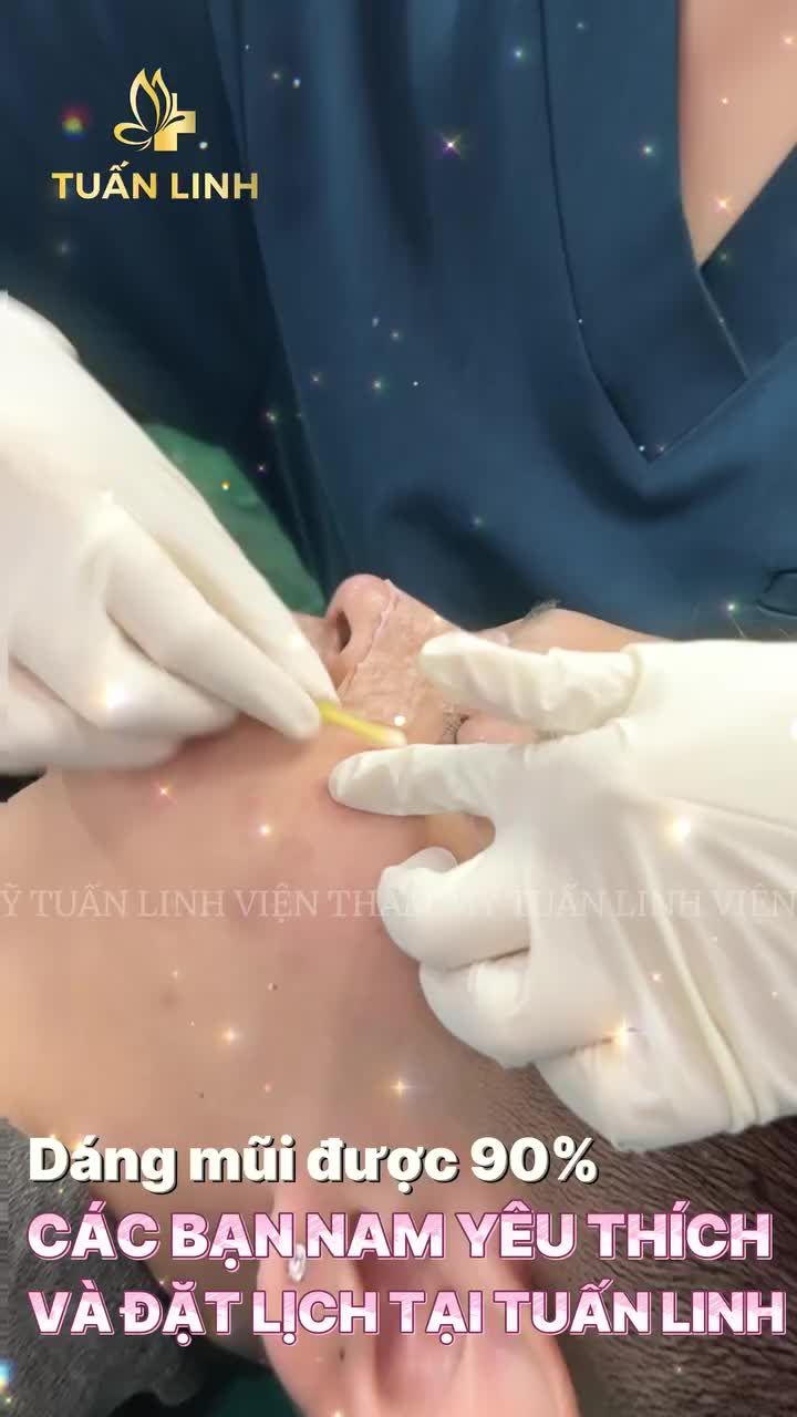 Dáng mũi được 90% các bạn nam yêu thích và đặt lịch tại Tuấn Linh Tham khảo ngay nha!