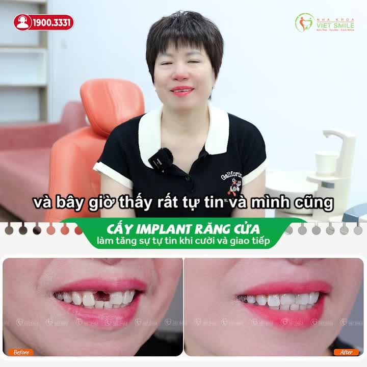 HẾT LỜI KHEN NGỢI DÀNH CHO NHA KHOA VIET SMILE