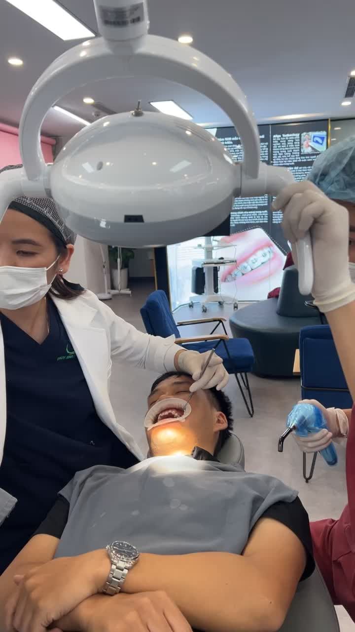 Quá trình gắn mắc cài bắt đầu quá trình chỉnh nha gặp tình trạng răng móm, khớp cắn ngược của bạn KH đến từ Bắc Giang.