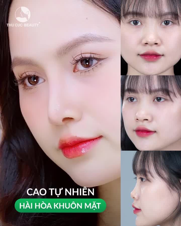 Giải pháp nâng mũi để phù hợp với khuôn