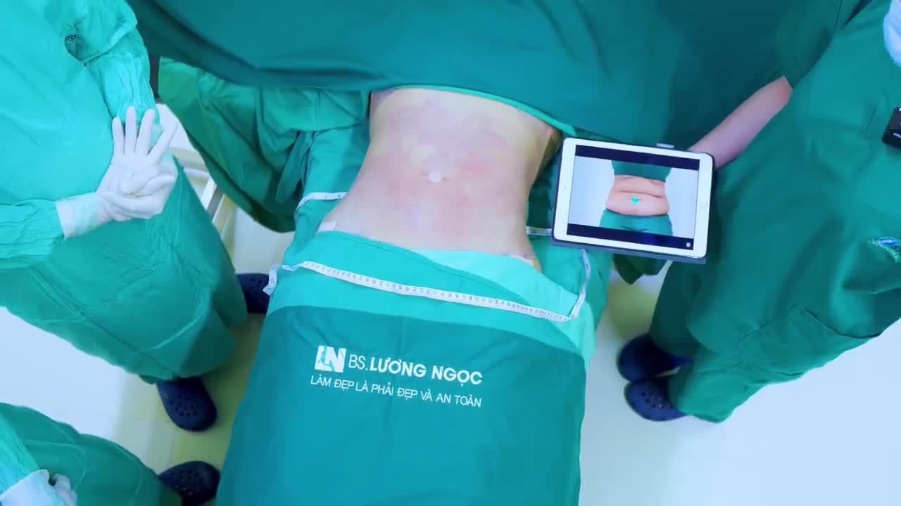 Không còn sồ sề, ngấn mỡ, chị Trâm giờ đây đã lấy lại đường cong body quyến rũ chỉ sau 60 phút thực hiện hút mỡ tạo dáng
