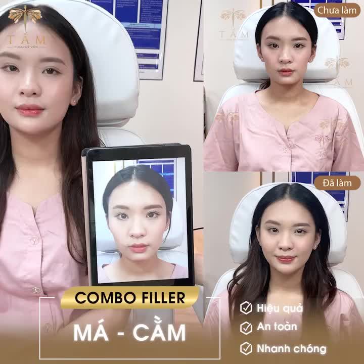 TỰ TIN TOÀN DIỆN VỚI COMBO FILLER MÁ - CẰM