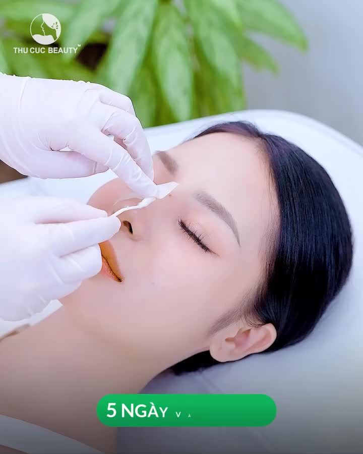 Thay đổi nhỏ gấp đôi nhan
