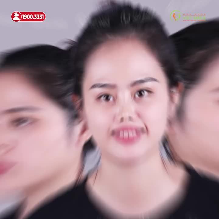 LÀM MŨI, TIÊM CẰM HAY CHỈ NIỀNG RĂNG?