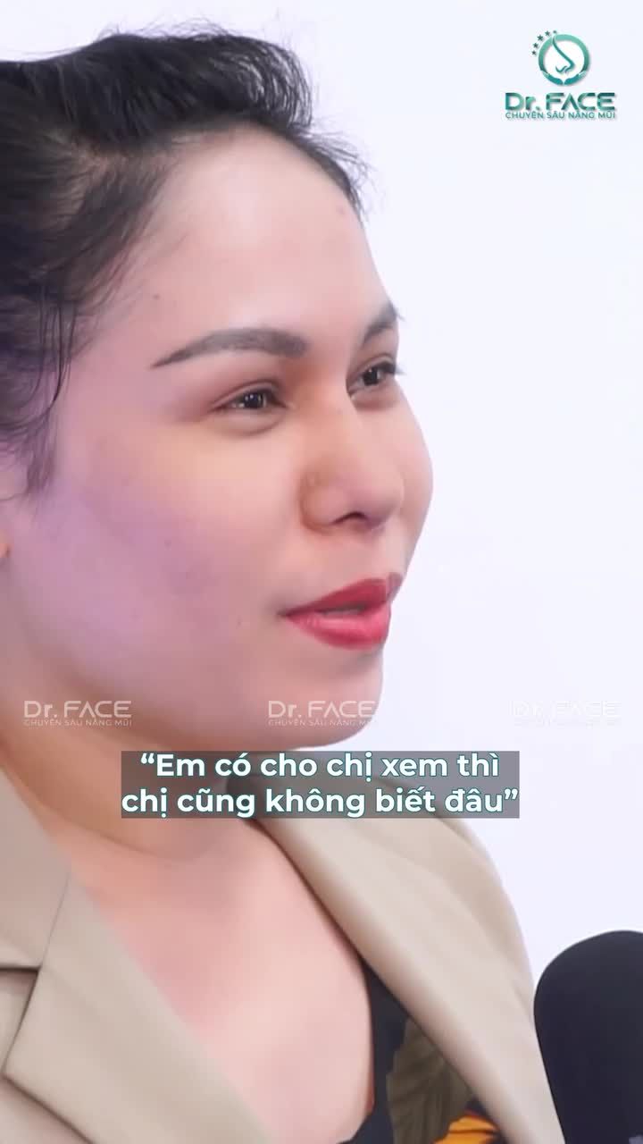 NÂNG MŨI gì mà BẤT ỔN quá vậy?