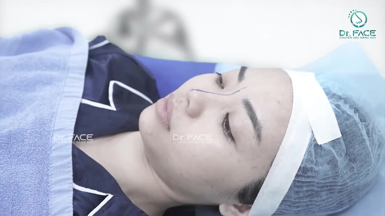 MUỐN MŨI GIỐNG PARK MIN YOUNG VÀ CÁI KẾT