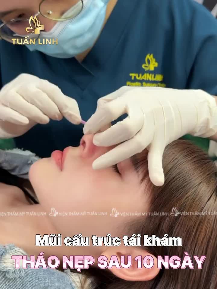 THÁO NẸP, TÁI KHÁM SAU 10 NGÀY NÂNG MŨI CẤU TRÚC!
