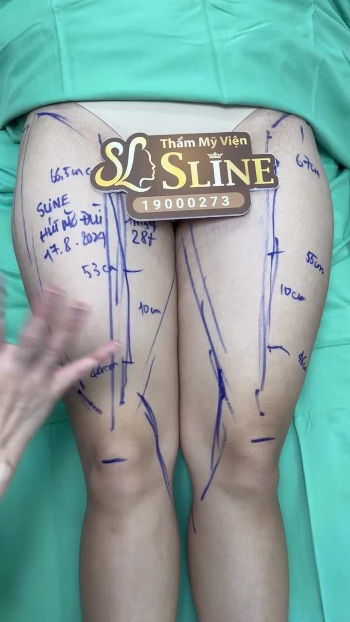 TẠM BIỆT ĐÙI ẾCH