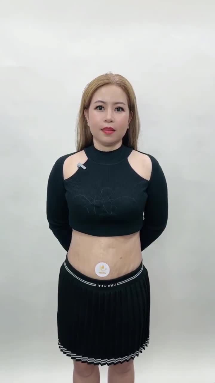 GẶP GỠ CHỊ MAI THANH (SINGAPORE) "LỘT XÁC" BODY HOÀN MỸ CHỈ SAU 14 NGÀY