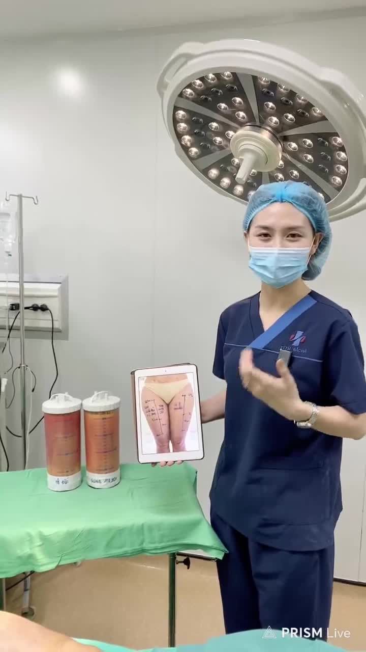 KẾT QUẢ HÚT MỠ ĐÙI
