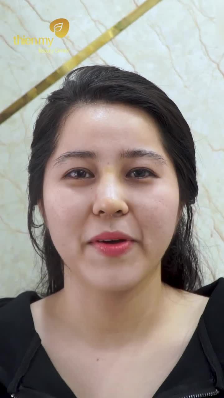 Khách hàng nói gì sau khi nâng mũi tại PKCK Thiện Mỹ