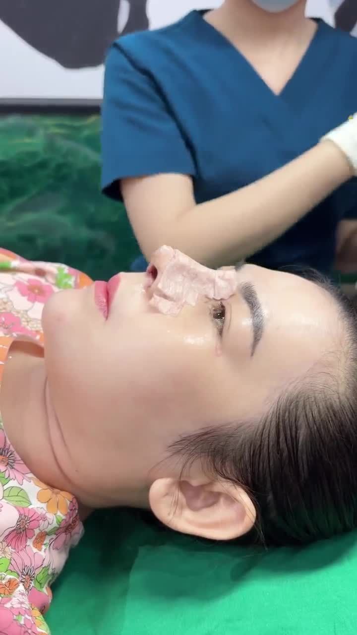 Mũi cấu trúc + Cuộn cánh 5 ngày tuổi