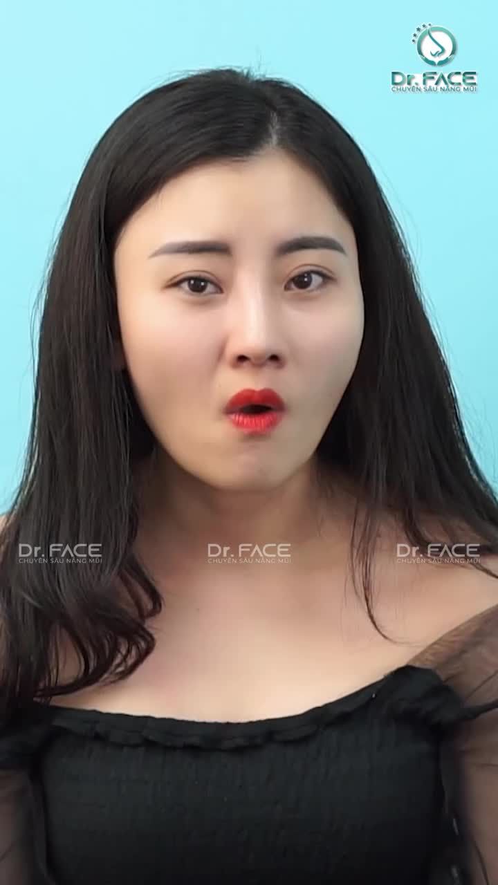 Quá khứ mũi CHẢY DỊCH, CO RÚT Quá ảm đạm!