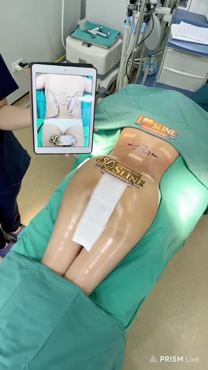 HÚT MỠ SIẾT EO 360° CHO BÀ MẸ 2 CON Xem ngay livestream để thấy sự thay đổi khác biệt