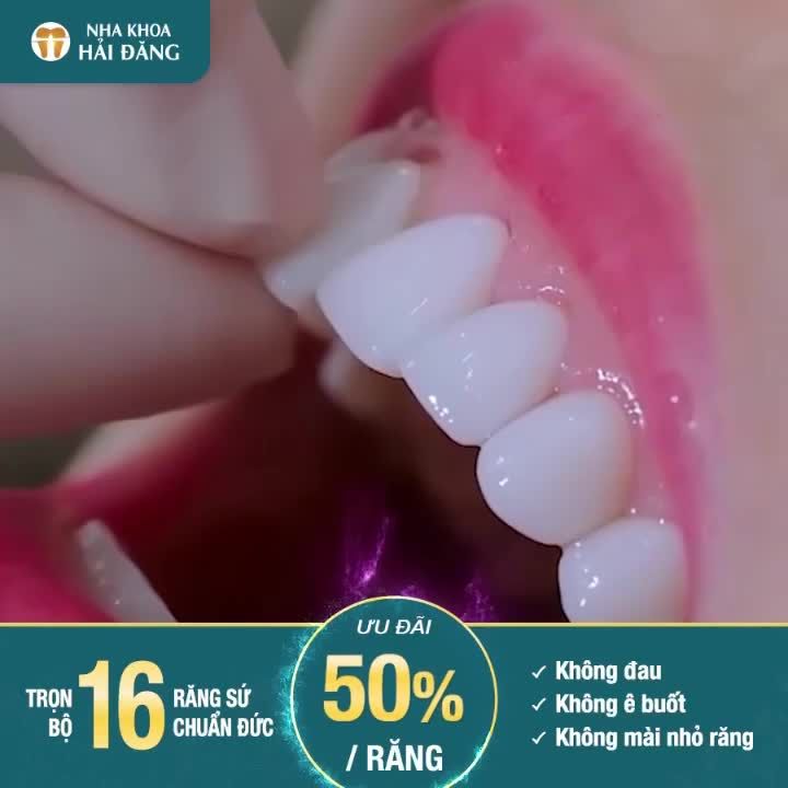 Cùng trải nghiệm dịch vụ chất lượng tại Nha Khoa Hải Đăng để sở hữu một diện mạo mới, nụ cười quyến rũ đầy tự tin.