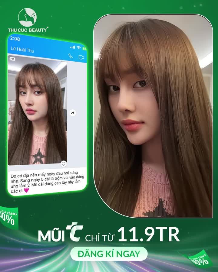 feedback nâng mũi Thu Cúc