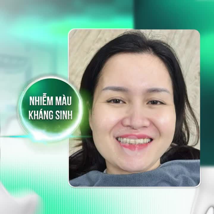 LẤY LẠI HÀM RĂNG CHẮC KHỎE, TỰ TIN CHỈ SAU 2 LẦN HẸN CÙNG CHUYÊN GIA