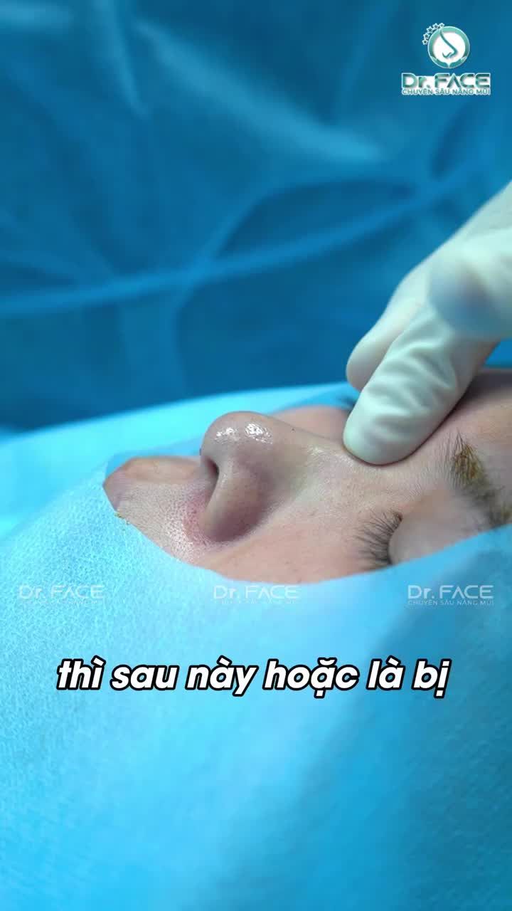 DA MỎNG thì liên quan gì tới NÂNG MŨI?
