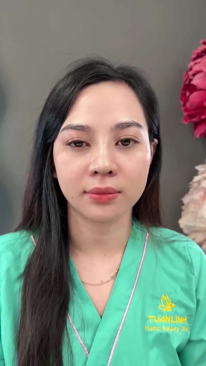Trẻ hơn 10 tuổi sau nâng mũi là có thật?