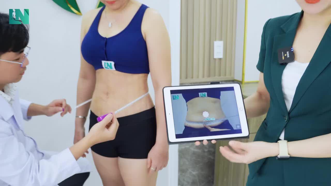 Trước khi đến với bác sĩ, chị Trang đã phải đối mặt với vùng bụng tích mỡ và chảy xệ nhiều năm.