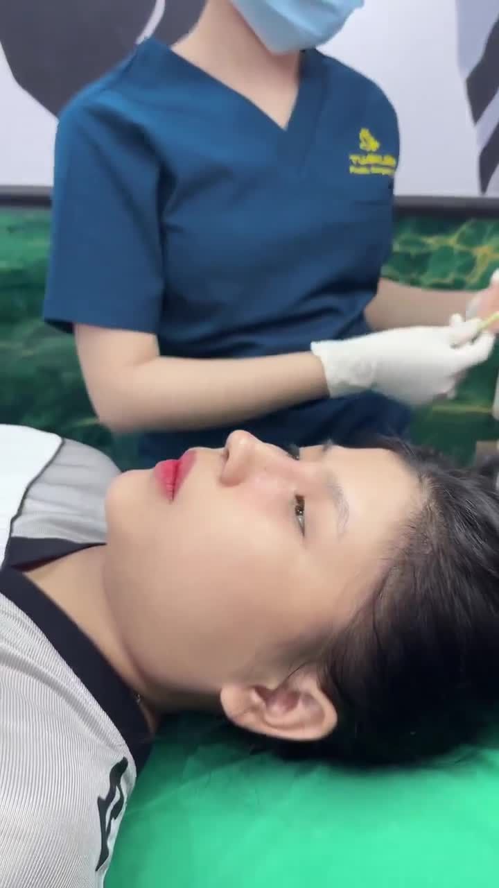 Tái khám sau 10 ngày nâng mũi cấu trúc cho bạn gái đến từ Quận 8!