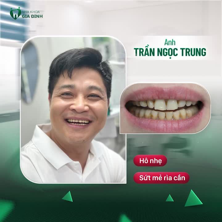 PHÁI MẠNH THAY ĐỔI NỤ CƯỜI - BẢO VỆ SỨC KHỎE - NÂNG TẦM THẨM MỸ