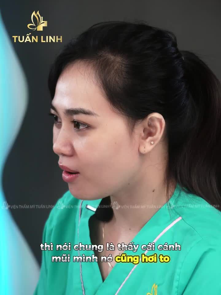 TRẺ HƠN 10 TUỔI SAU NÂNG MŨI Kiểm chứng ngay bằng clip bên dưới nha!