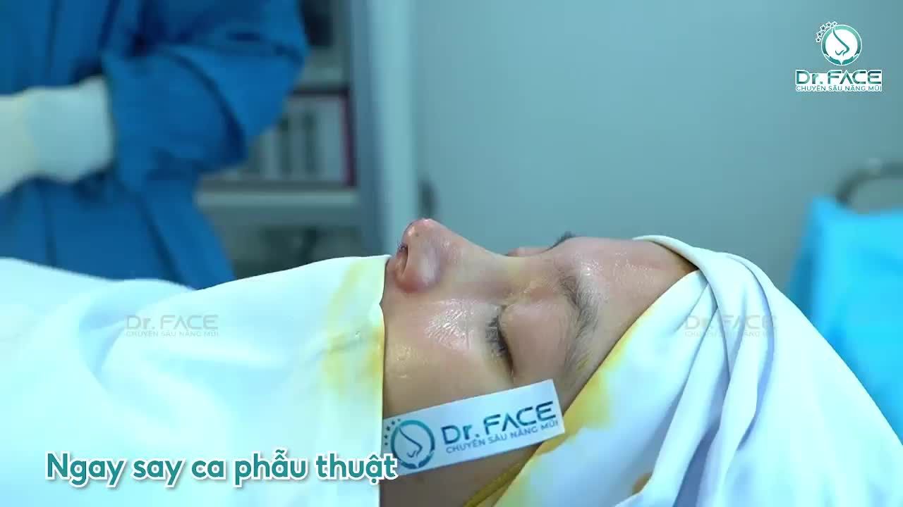 Mũi Bẩm Sinh Vẫn Lệch Xương, Vẹo Vách Ngăn Nè Mọi Người