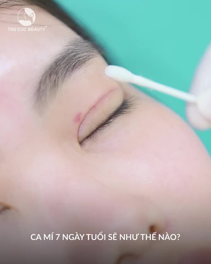 Ca mí sau 7 ngày đẹp mê ly