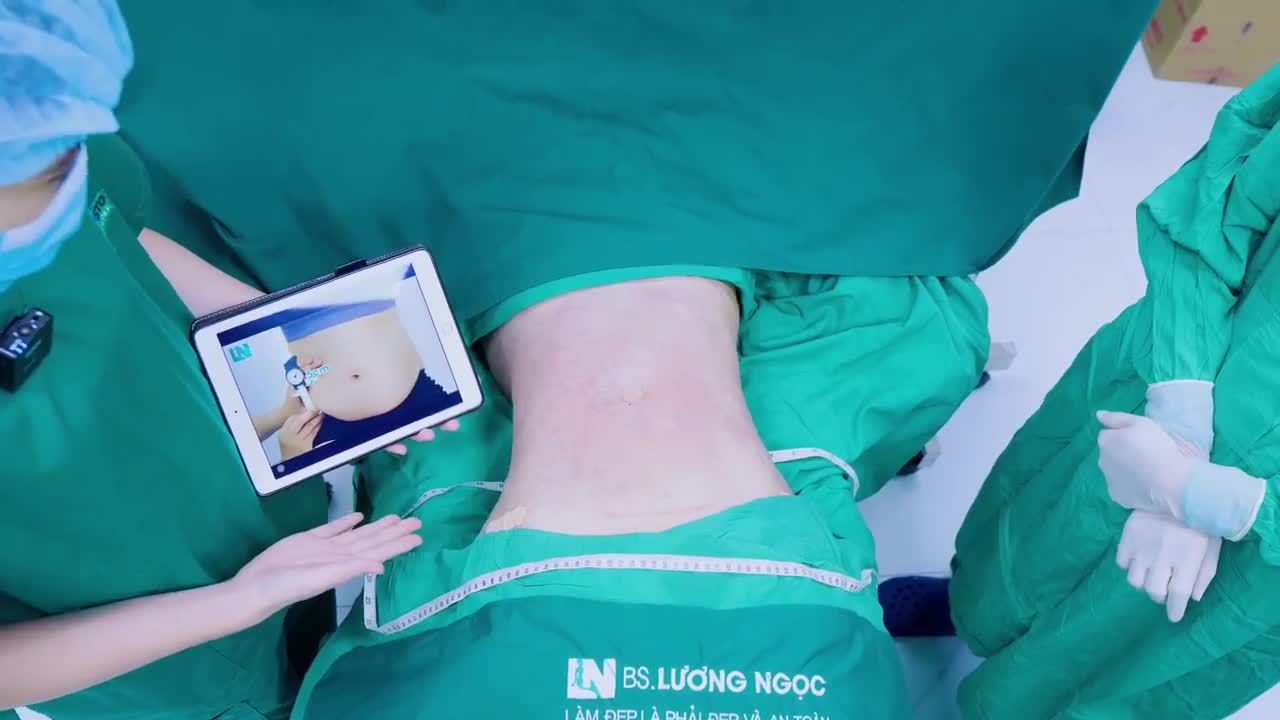 “Vòng eo con kiến”, vóc dáng “thắt đáy lưng ong” không còn là mơ ước!