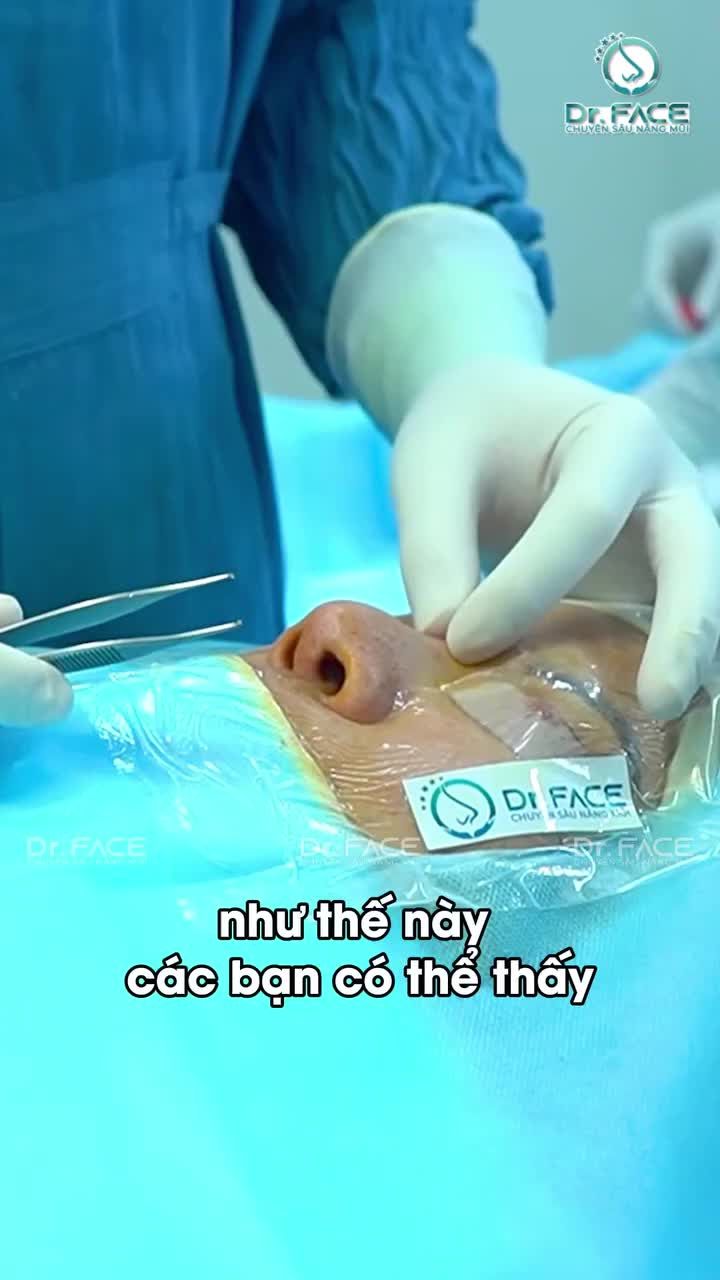 COI SILICONE “LẮC LƯ” NÈ…