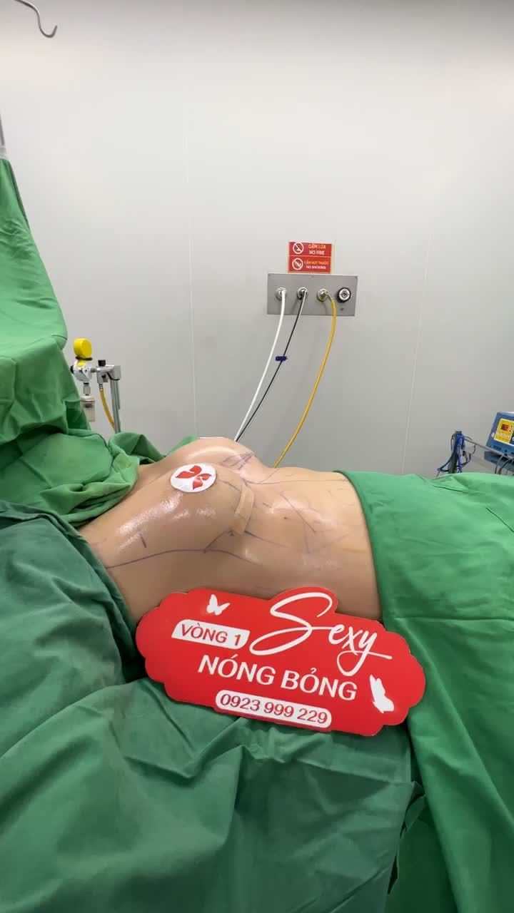 HOÀN THÀNH DÁNG NGỰC MENTOR 300cc