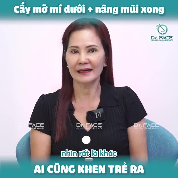 CẤY MỠ MÍ DƯỚI + NÂNG MŨI xong ai cũng khen TRẺ RA