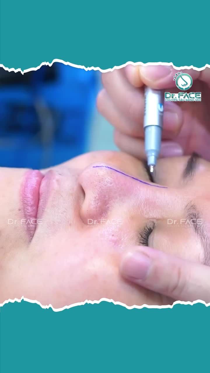 KHÁCH LO BS MỆT không PT được hả?