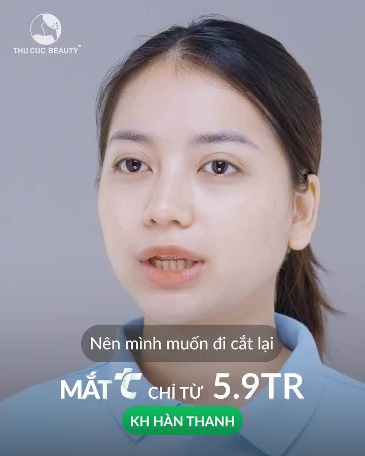 Nếp mí nhỏ đẹp, tự nhiên mà ai cũng mong