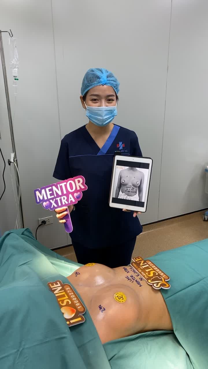 MENTOR XTRA 270CC Ca phẫu thuật được thực hiện bởi ekip Sline tại bệnh viện Đa Khoa Quốc Tế Bắc Hà