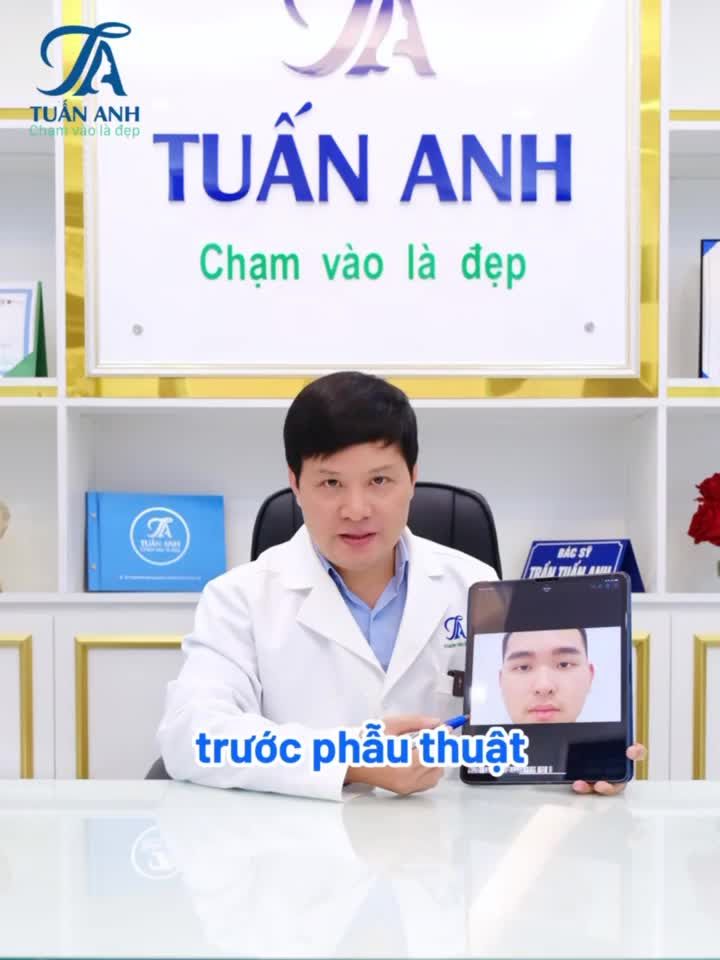 "Lột xác" cùng chàng. trai 2K5 với dịch vụ cắt mí + nâng mũi tại Thẫm mỹ Tuấn ANh