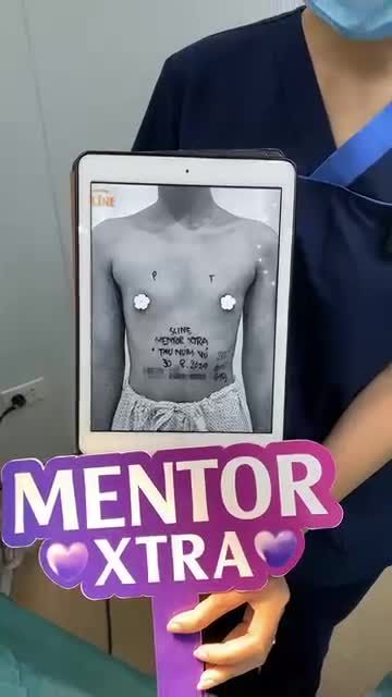 KẾT QUẢ CA MENTOR XTRA TIẾP THEO