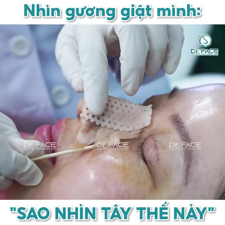 Làm MẮT + MŨI xong giật mình: “Sao nhìn Tây thế này”
