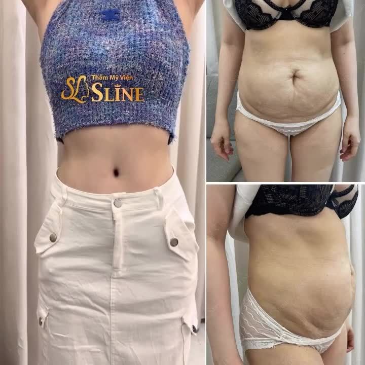 Sline hoàn thành mong muốn được diện croptop bấy lâu dành cho mẹ bỉm sữa!