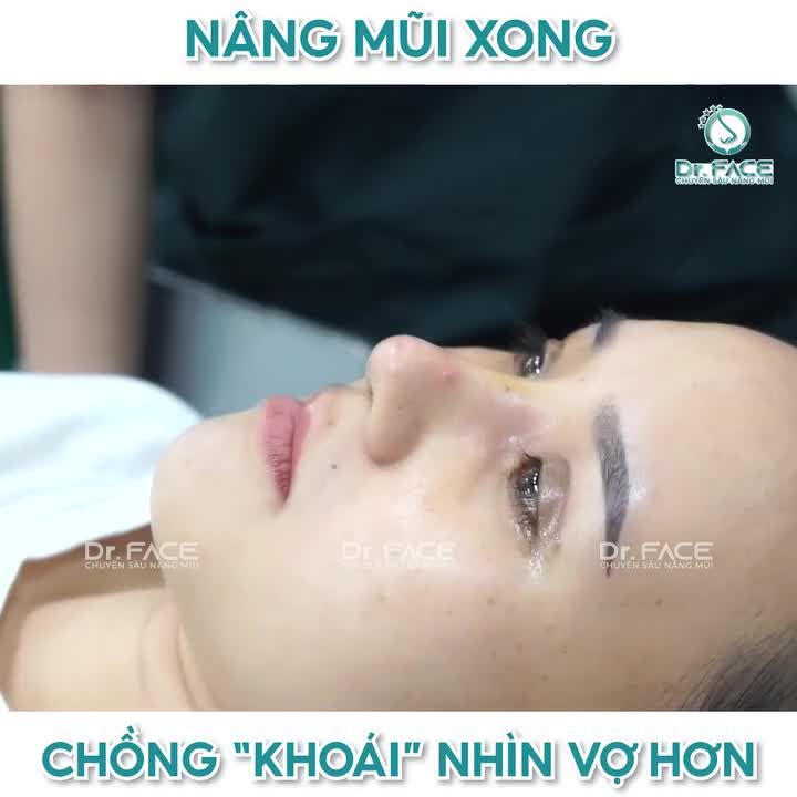 Nâng Mũi Xong Chồng “Khoái” Nhìn Vợ Hơn