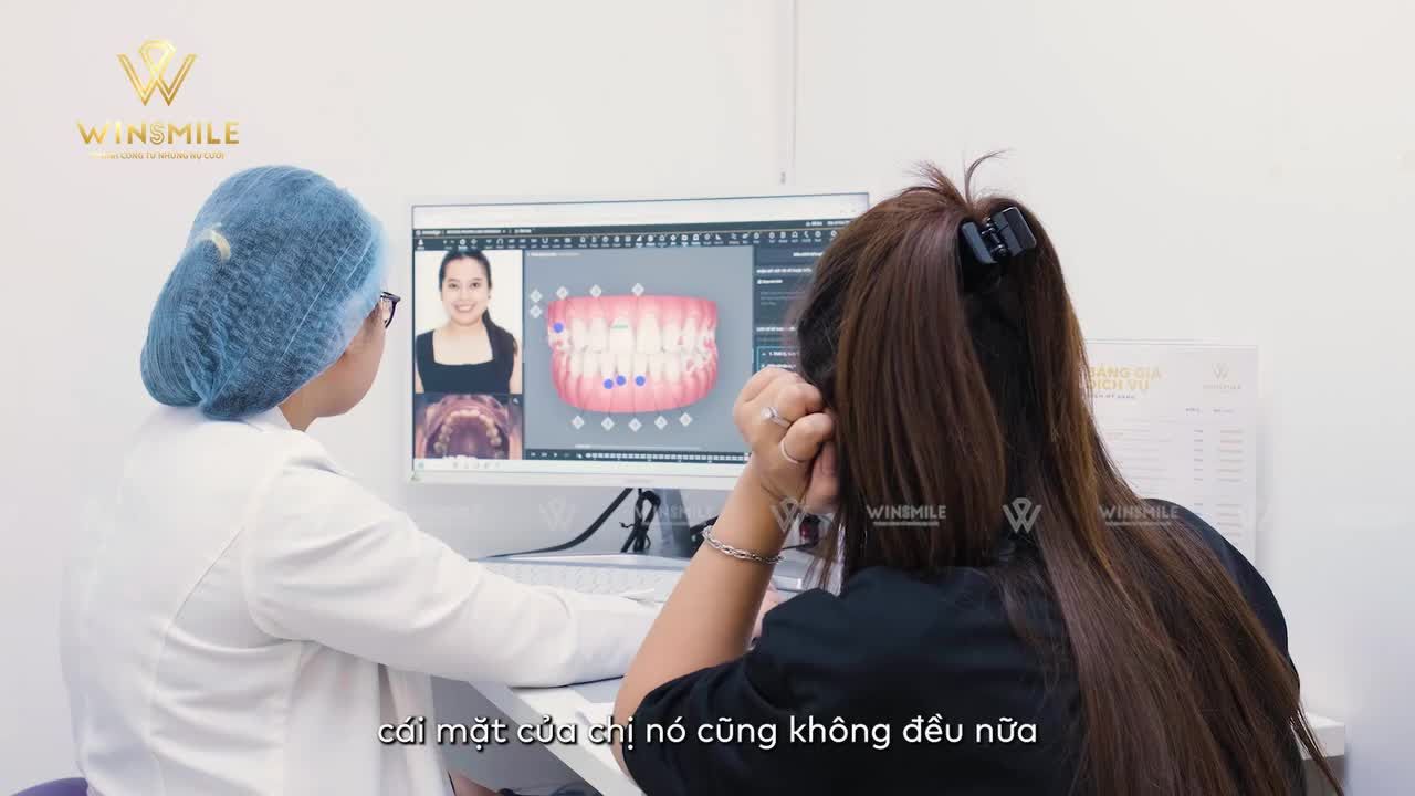 LỆCH MẶT DO THÓI QUEN ĂN NHAI MỘT BÊN VÀ TIẾN TRÌNH ĐIỀU TRỊ BÁC SĨ ĐƯA RA THÔNG QUA CLINCHECK