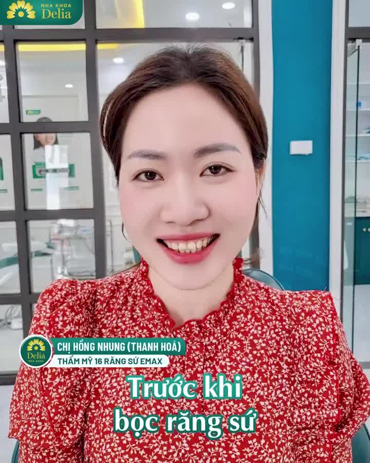 TOP 5 ca bọc RĂNG SỨ thành công tại DELIA