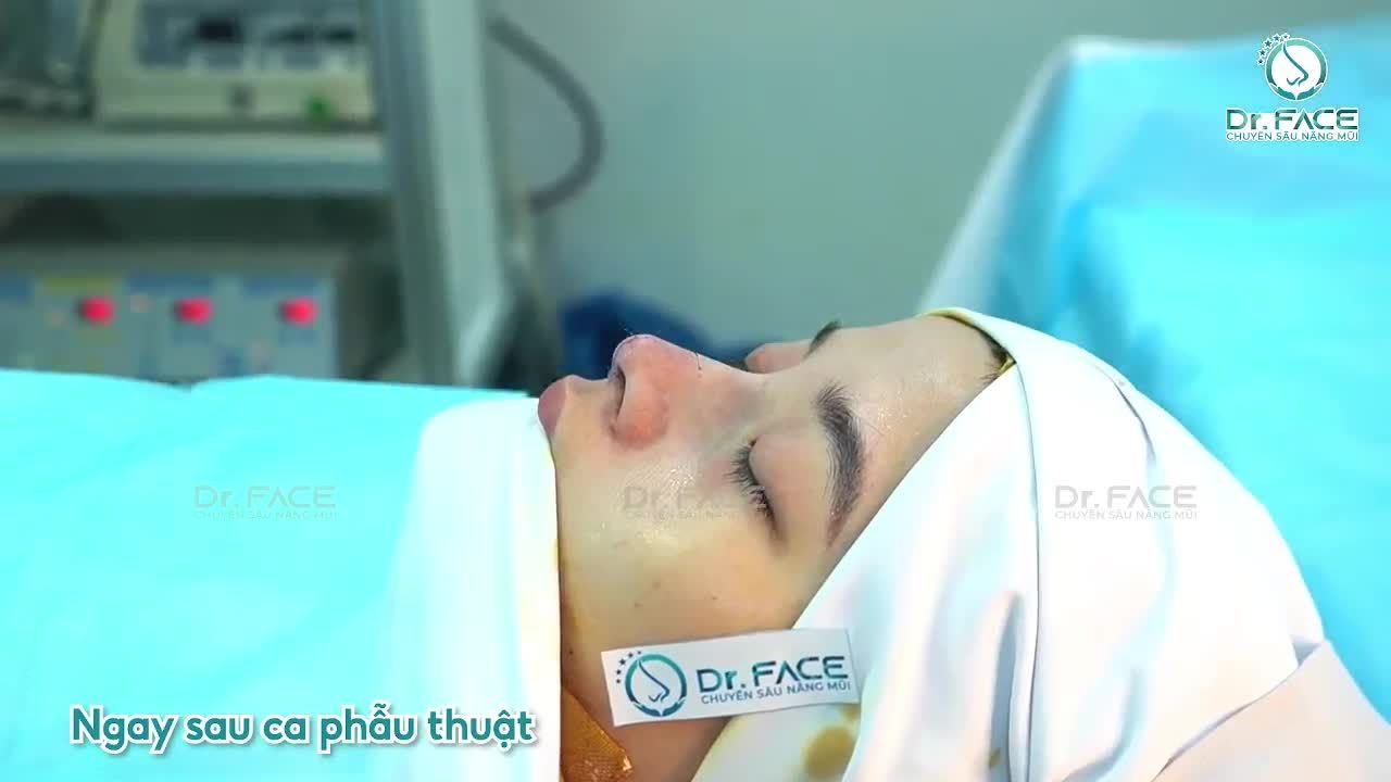 Chiếc Mũi Bạn Kiều Bào Philippines Này Chắc Chắn Sẽ Đẹp