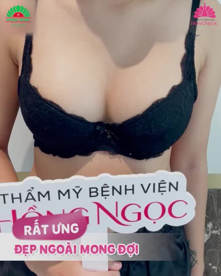 GÓC NGƯỜI THẬT VIỆC THẬT: NGỰ.C ĐẸP NGOÀI MONG ĐỢI SAU PT NÂNG V1 DUAL PLANE