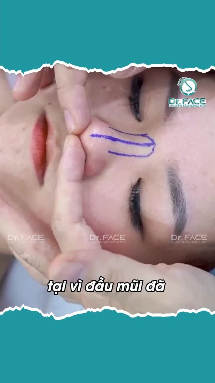 NÂNG VỪA thôi cho an toàn mà VẪN TÂY được không bs