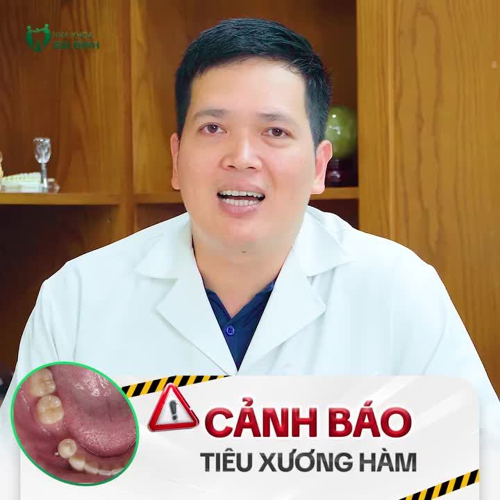 CẢNH BÁO: ĐỪNG ĐỂ MẤT RĂNG ĐẾN KHI TIÊU XƯƠNG HÀM MỚI PHỤC HÌNH IMPLANT