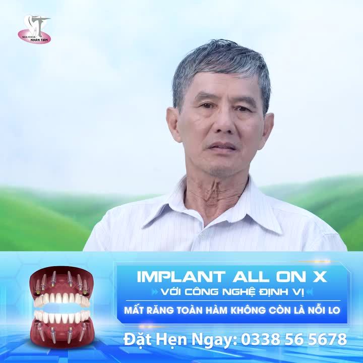 Trồng Răng Implant - Lấy Lại Tự Tin Cùng Nụ Cười Thoải Mái