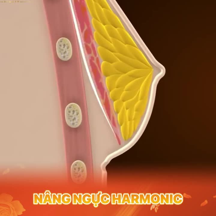 NHỮNG LÍ DO KHÁCH HÀNG LỰA CHỌN NÂNG V1 TẠI DRD :