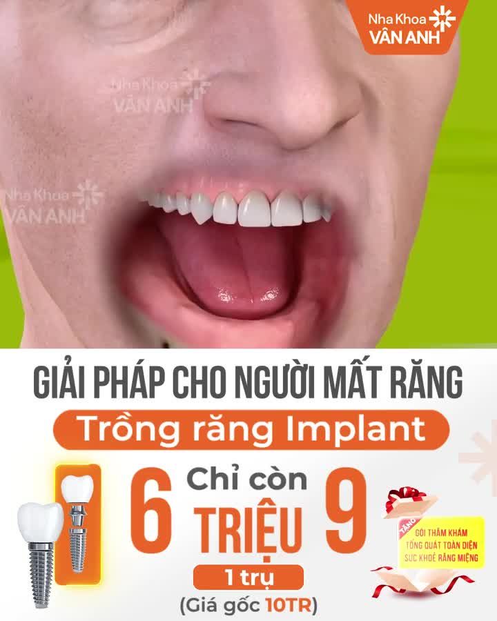 3 PHƯƠNG PHÁP TRỒNG RĂNG IMPLANT ĐƯỢC BÁC SĨ KHUYÊN DÙNG